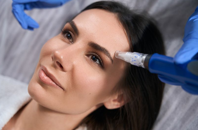 ¿Pueden los esteticistas realizar el microneedling?, CEM Canarias